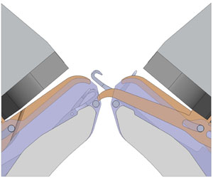 New Dynamic Sinker system